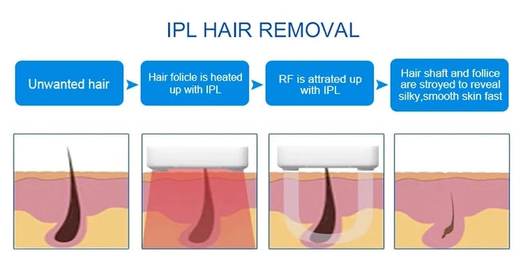 IPL OPT 3 In 1 Permanent Hair Removal E-light Epilator Nd Yag Laser Tattoo Removal RF Wrinkle Removal Whitening Facial Lift CE