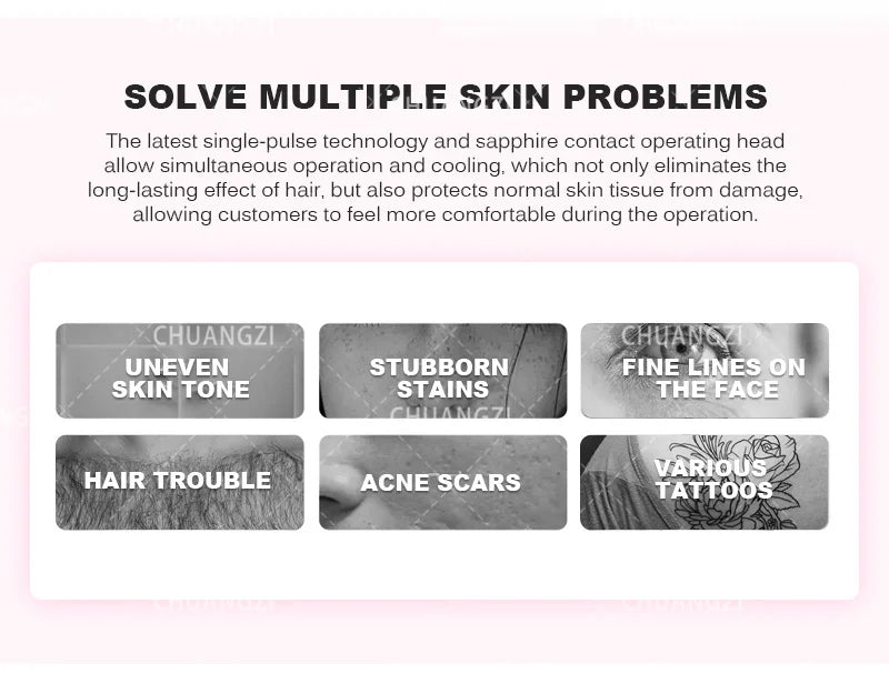 IPL OPT 3 In 1 Permanent Hair Removal E-light Epilator Nd Yag Laser Tattoo Removal RF Wrinkle Removal Whitening Facial Lift CE