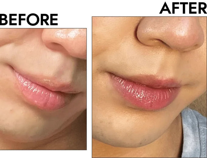 EELHOE Ceramide Lip Balm Stick for Dry Chapped Lips Hydrating Plumping Effect Moisturizing Soothing Nourishing Lip Care Glossy